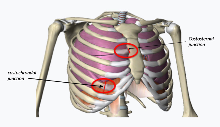 Costosternal and costochondral junctions