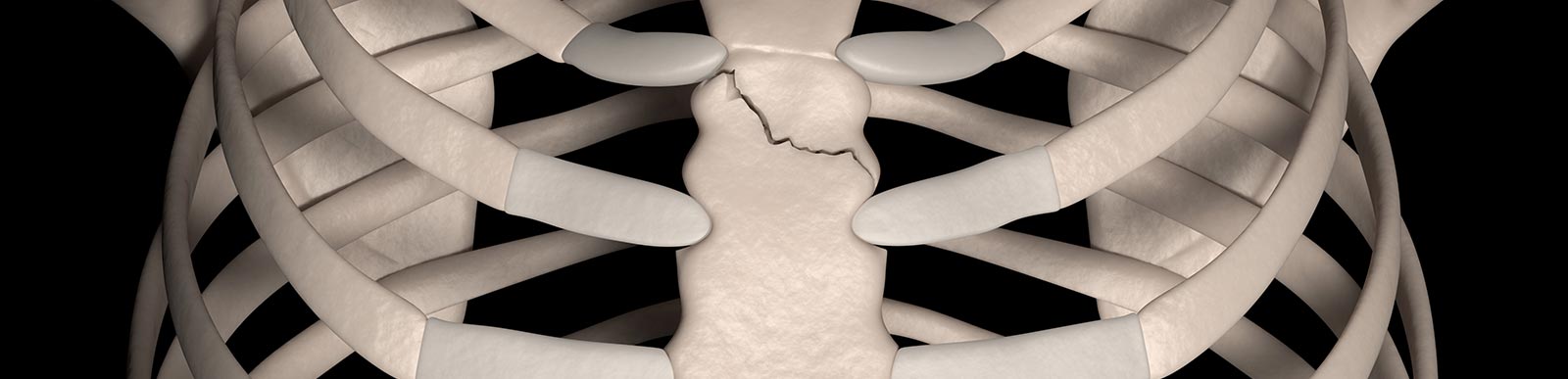 Complex chest wall injuries