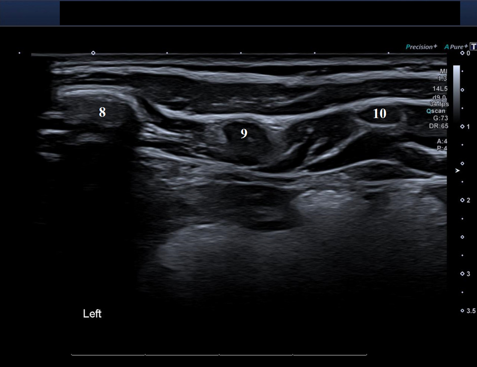 Ultrasound Before